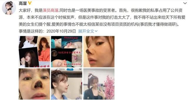 整形失败去世的女明星(12位被整形毁掉的女星)(13)