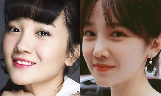 整形失败去世的女明星(12位被整形毁掉的女星)(30)