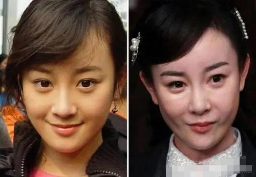 整形失败去世的女明星(12位被整形毁掉的女星)(11)