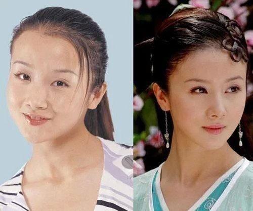 整形失败去世的女明星(12位被整形毁掉的女星)(4)