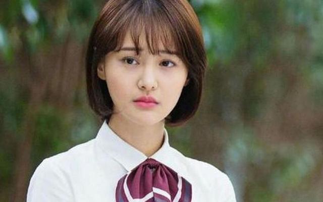 整形失败去世的女明星(12位被整形毁掉的女星)(42)