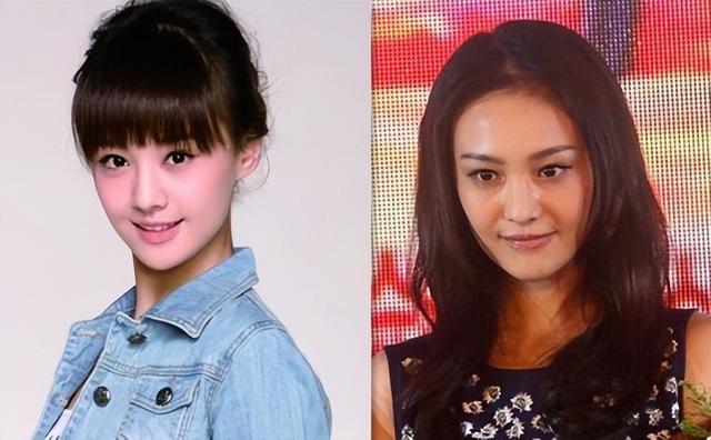 整形失败去世的女明星(12位被整形毁掉的女星)(41)