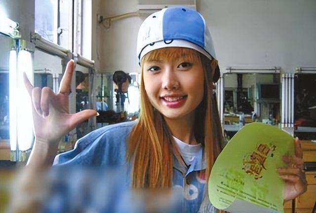 整形失败去世的女明星(12位被整形毁掉的女星)(49)