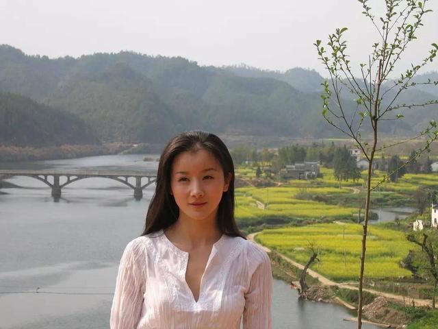 整形失败去世的女明星(12位被整形毁掉的女星)(3)