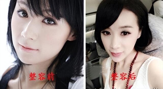 整形失败去世的女明星(12位被整形毁掉的女星)(34)