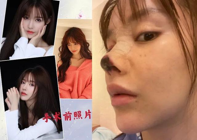 整形失败去世的女明星(12位被整形毁掉的女星)(14)