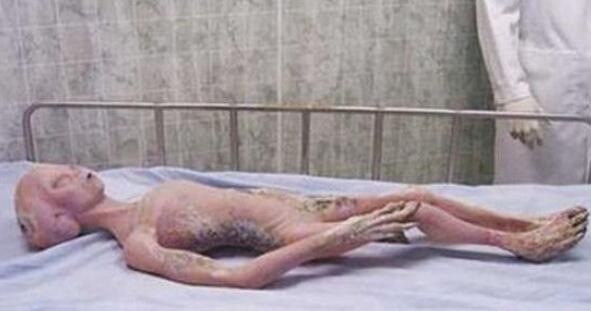 美国保持有外星人的尸身,外星人尸身剖解材料