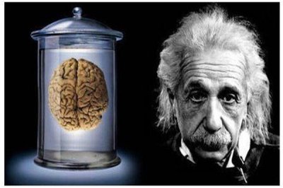 ​为什么要切爱因斯坦的大脑：爱因斯坦的大脑与正常人不同