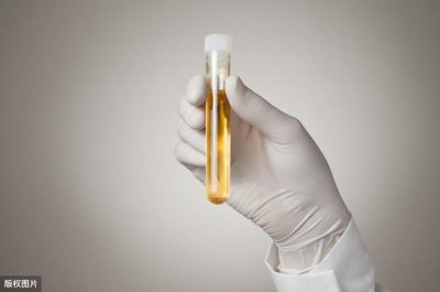 ​糖尿病早期的10个前兆（糖尿病的早期症状）