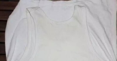 ​衣服发黄，衣服发黄怎么恢复？