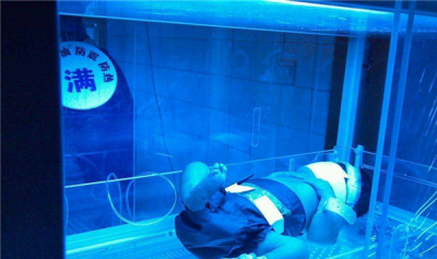 ​照蓝光变乌后怎样回复 鼎盛儿蓝光调节的看护