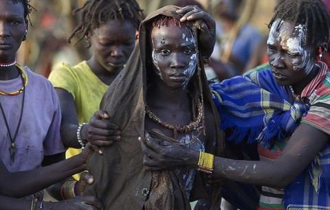 割礼是割什么部位,是女性吗