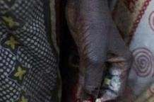 割礼指的是什么地方,非洲割礼是怎么一回事图2