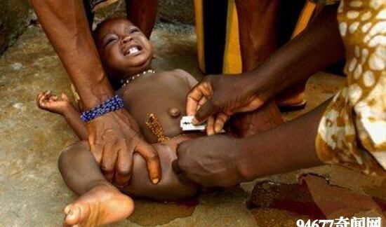 割礼是什么意思