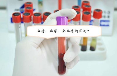 ​血浆和血液的区别 如何区分血清血浆及溶血问题？