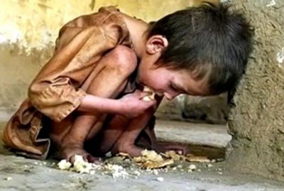 ​图揭饥饿的非洲儿童，看着令人揪心，网友：再也不浪费粮食了~
