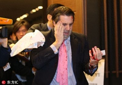 ​俄大使遭枪杀震惊全球 回顾近年各国外交官遇袭事件