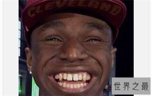 世界上第一大嘴巴,居然能塞下138根铅笔