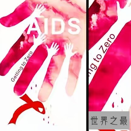 世界上最早被发现的艾滋病,1981年之后开始遍布全世界。