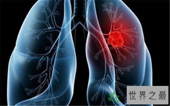 世界最毒的物质,0.01g毁灭全地球的人