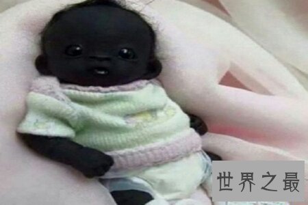 世界上最黑的小孩,虽然黑但是非常呆萌可爱