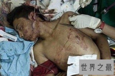 ​全国十大暴力城市大多以暴力拆迁出名 暴力执法的背后究竟有何依靠