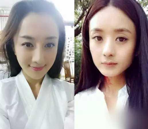 被叶璇的宠物咬了的李依晓缝了20针，整容了5次