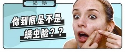 ​被抖音炒火的螨虫皂真的那么好用吗？醒醒，买它就是浪费钱