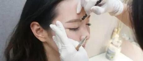 半永久纹绣……雾眉失败之后……你哭了没？