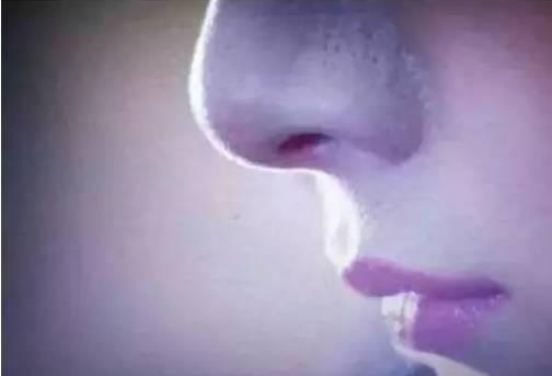 去黑头最好的方法和小妙招（去除黑头的六种方法）(3)