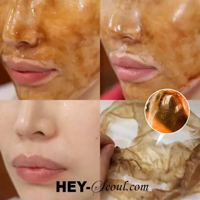 去黑头最好的方法和小妙招（去除黑头的六种方法）(16)