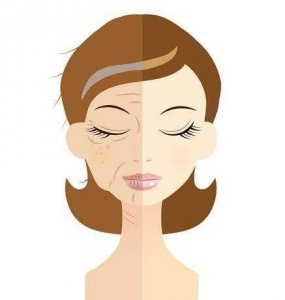 ​怎么区分真性皱纹和假性皱纹(真假性皱纹的区别)