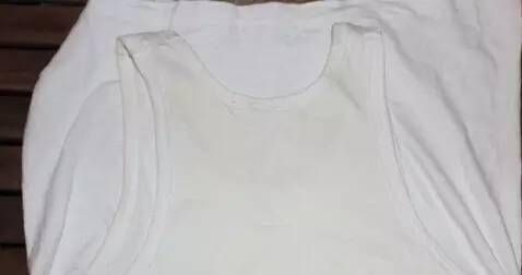 衣服发黄怎么处理