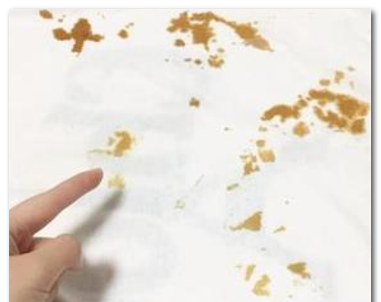 衣服发黄怎么清洗最有效,白衣服发黄怎么洗可以变白图8