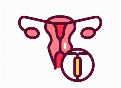 ​上曼月乐环疼吗(上曼月乐环疼吗什么感觉)