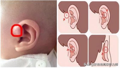 ​这些都是有福气的象征？耳仓、拴马桩耳、耳垂大...是真的吗