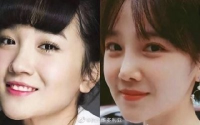​陈小纭公开承认曾“整容”十几次，旧照曝光后，网友：差距太大了