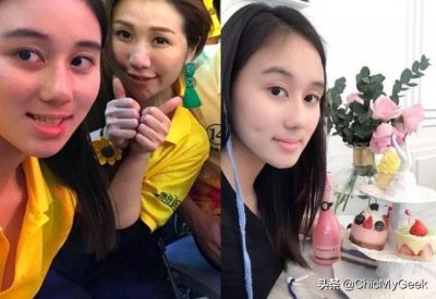 ​张敬轩整容了嘛(9位明星箍牙前后对比)