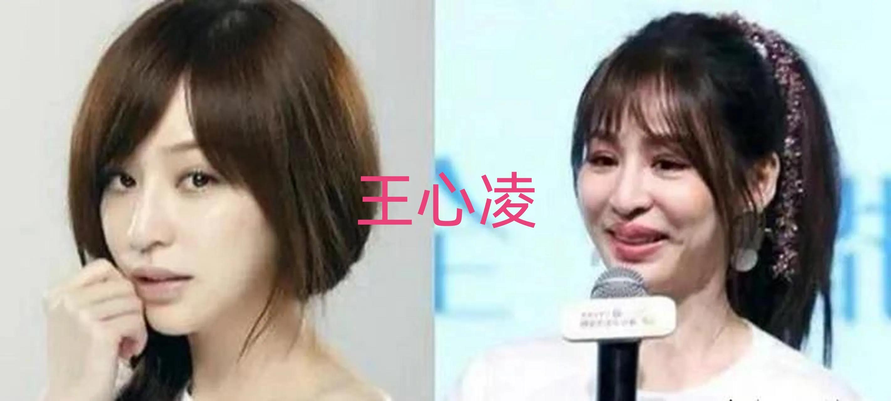 娱乐圈整容失败的十大女星 ，谁最可惜？娄艺潇、金晨、蔡卓妍，还是李小璐