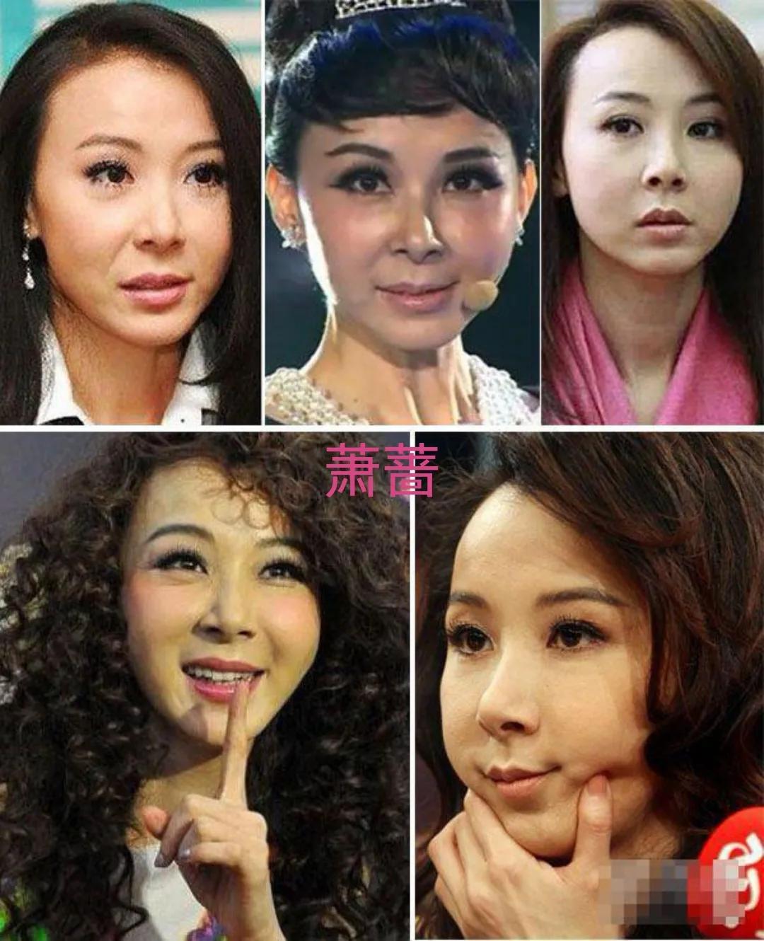 娱乐圈整容失败的十大女星 ，谁最可惜？娄艺潇、金晨、蔡卓妍，还是李小璐