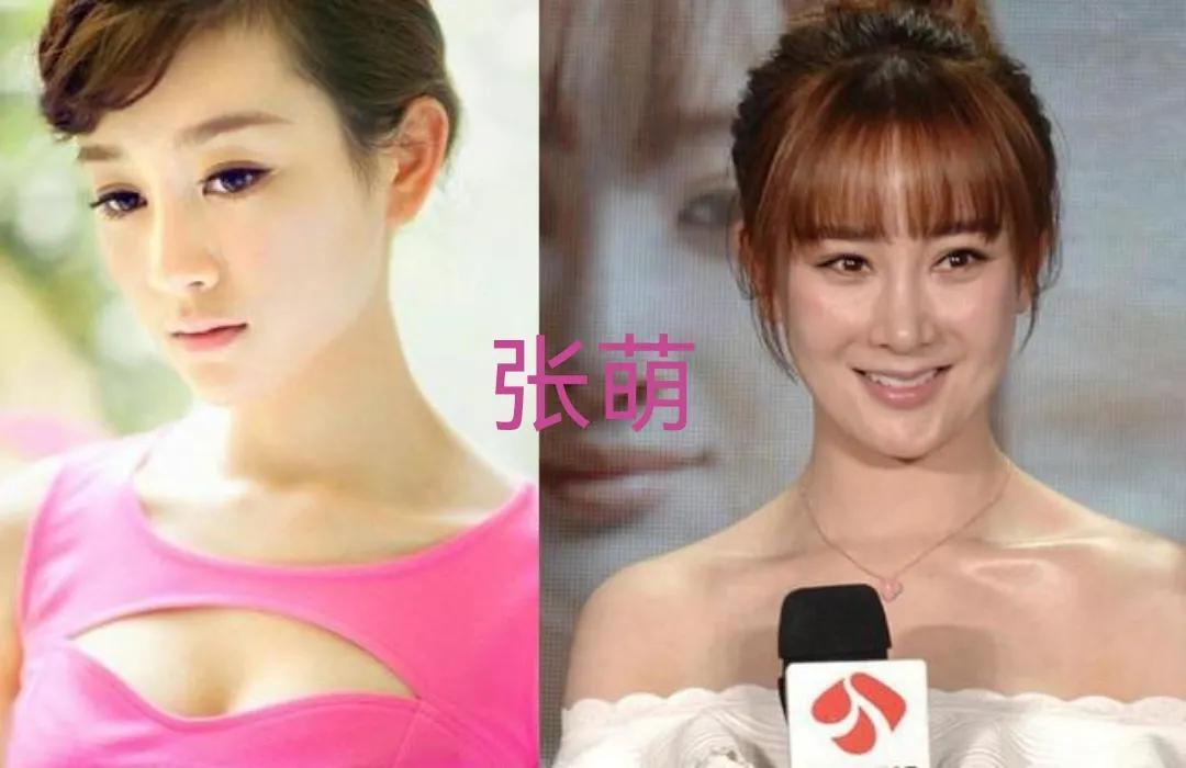 娱乐圈整容失败的十大女星 ，谁最可惜？娄艺潇、金晨、蔡卓妍，还是李小璐