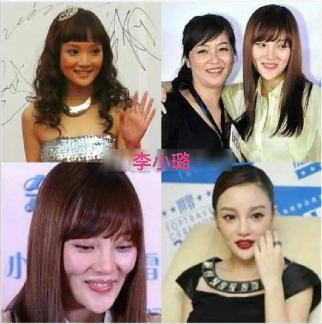 娱乐圈整容失败的十大女星 ，谁最可惜？娄艺潇、金晨、蔡卓妍，还是李小璐