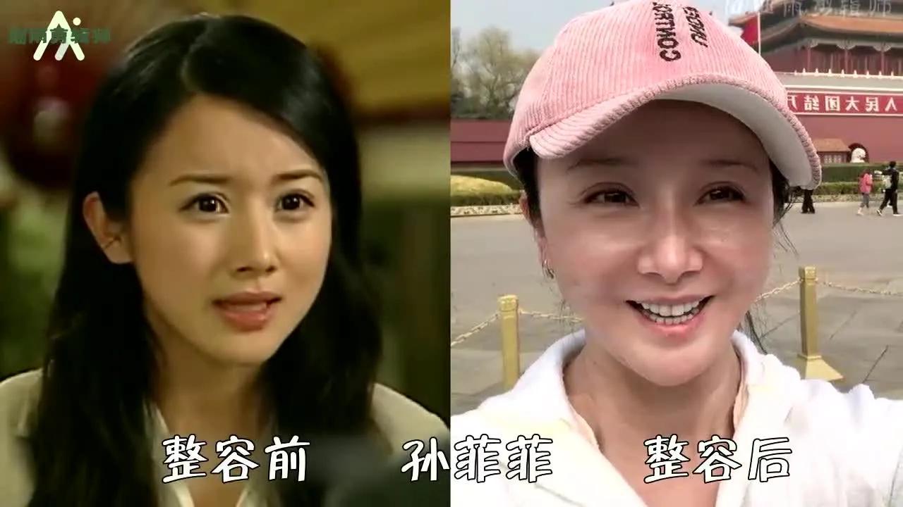 娱乐圈整容失败的十大女星 ，谁最可惜？娄艺潇、金晨、蔡卓妍，还是李小璐