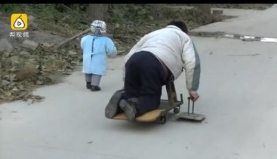 ​先天小儿麻痹症症状(小儿麻痹症症状的原因)