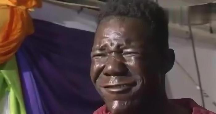 世界上最丑的人，5次选丑大赛4次都是冠军，看完根本吃不下饭！