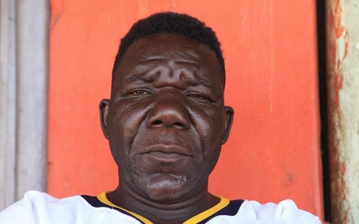 世界上最丑的人，5次选丑大赛4次都是冠军，看完根本吃不下饭！