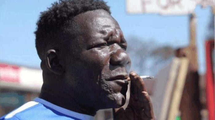 世界上最丑的人，5次选丑大赛4次都是冠军，看完根本吃不下饭！