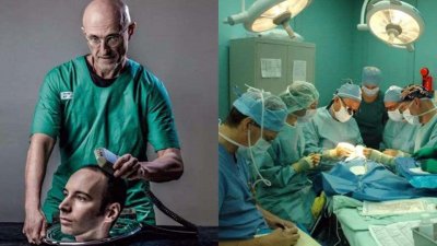 ​世界首例换头手术成功了吗？手术结果如何？志愿者现在怎么样了？