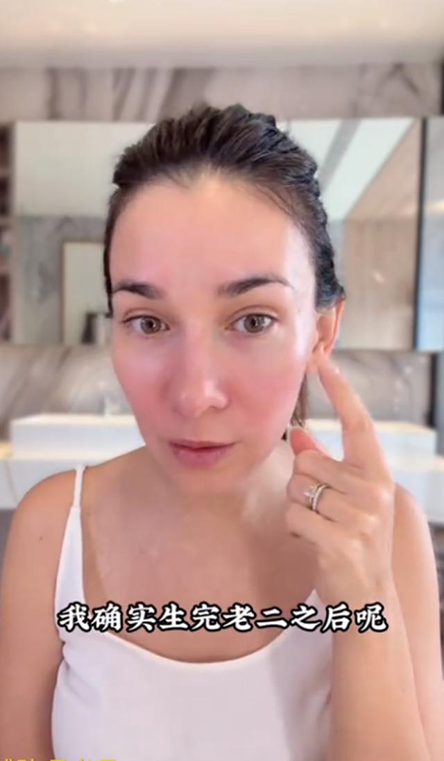 卢靖姗二胎后晒素颜，脸上长斑却被全网夸：这才是妈妈最真实样子