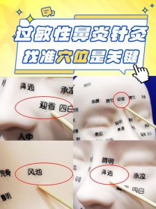 鼻子打针破坏风水吗